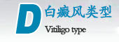 白癜風(fēng)類(lèi)型